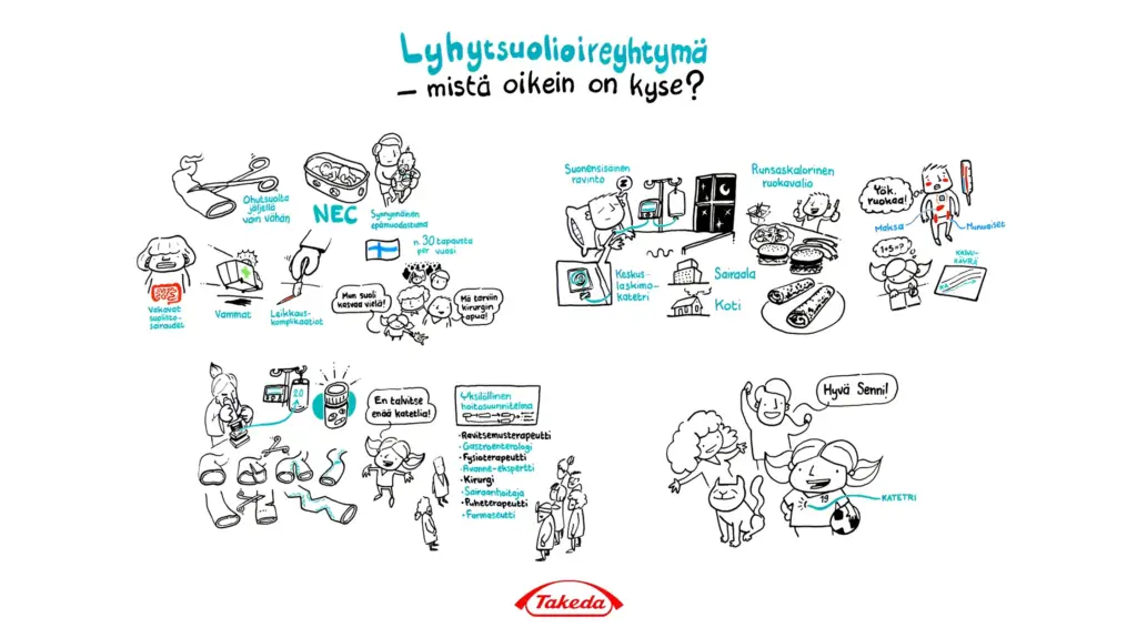 Lyhytsuolioireyhtymä